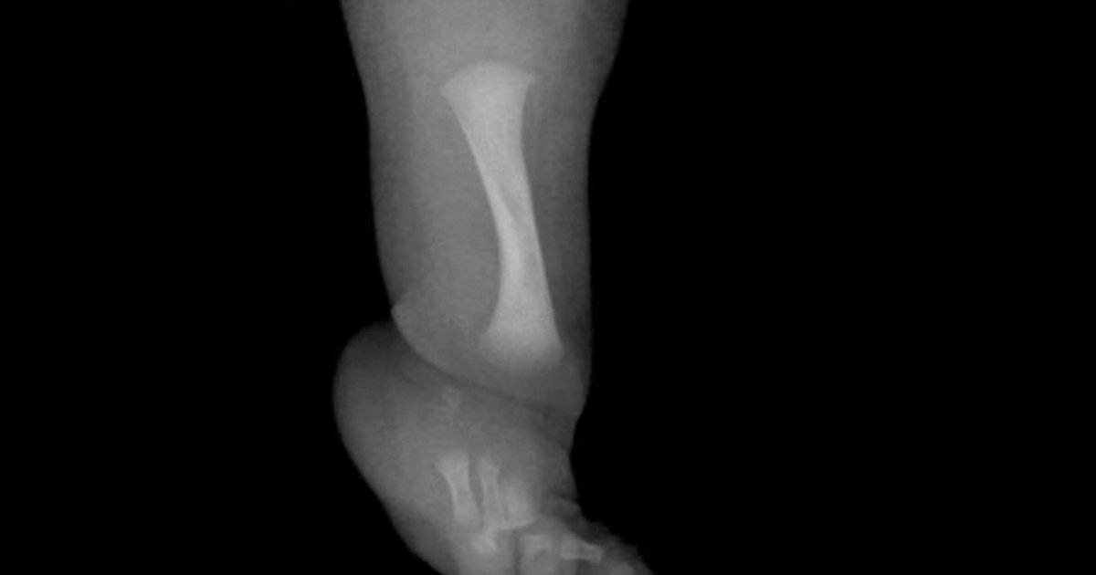 vVlKr6QzW 1200x630 1