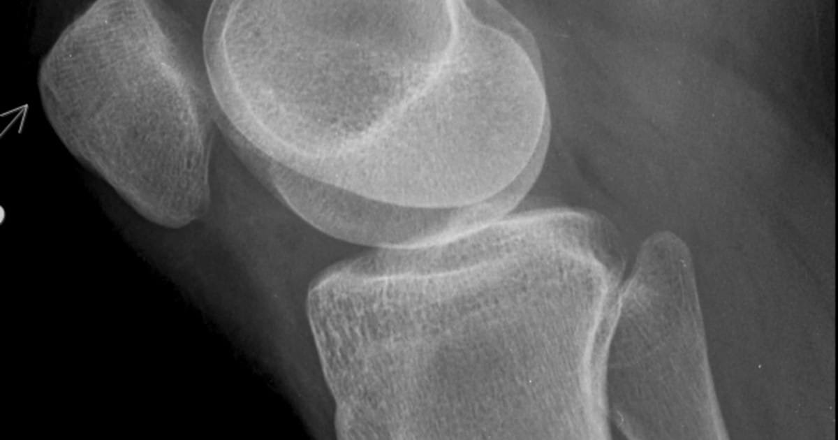 1Tav918Df 1200x630 1