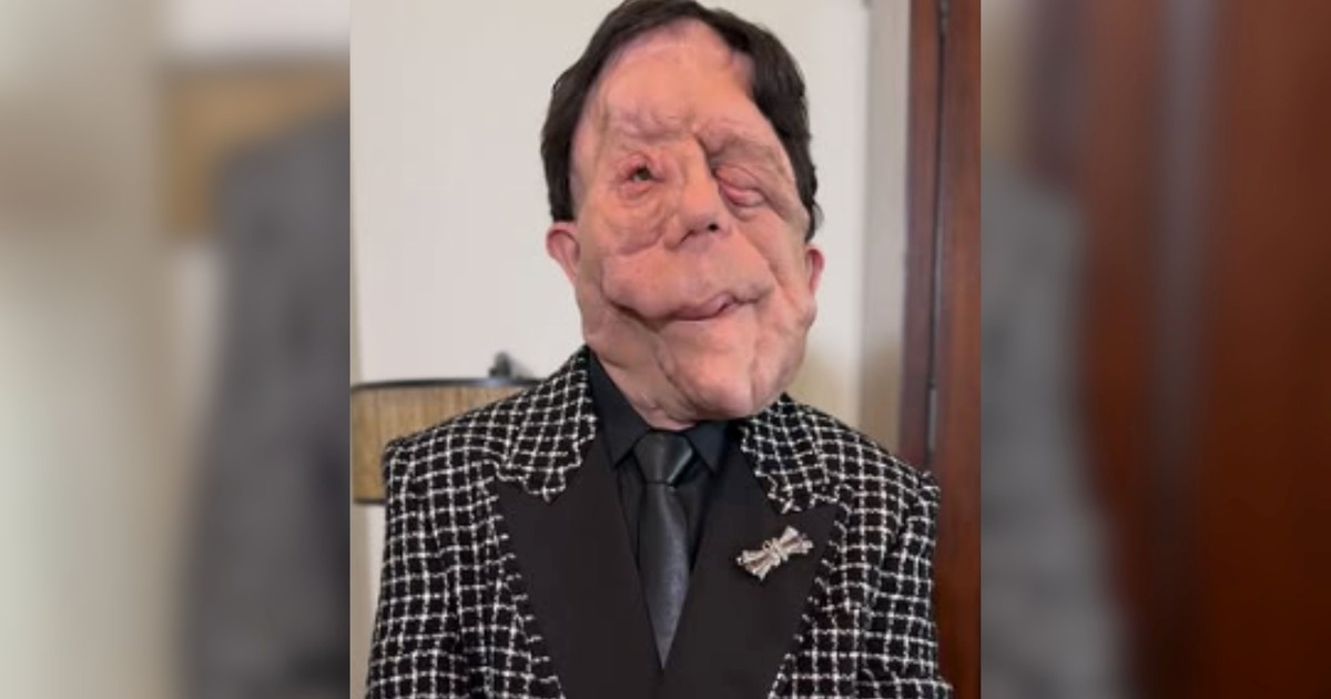 BtR75ynYh 1200x630 1