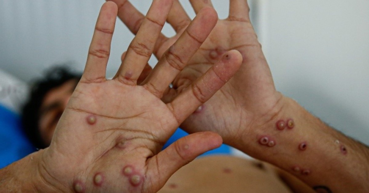 LcjBZpMBq 1200x630 1