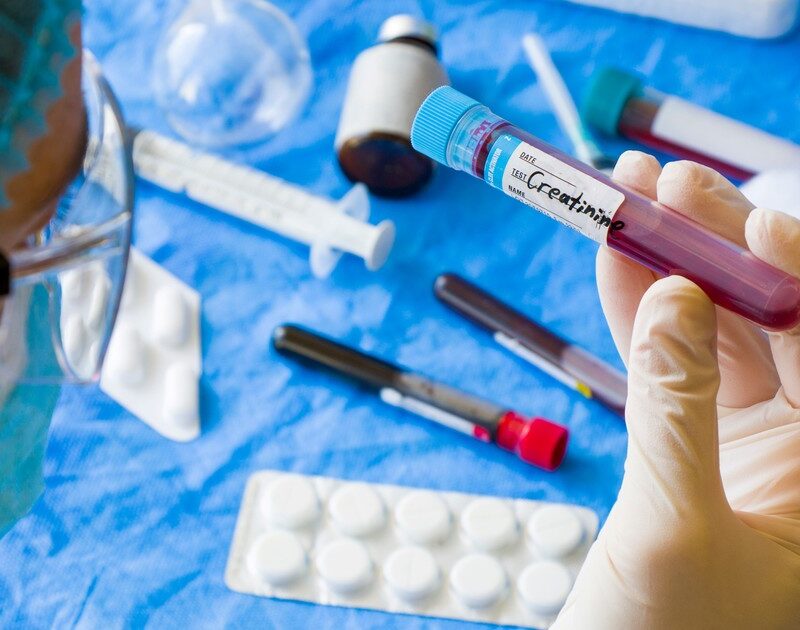 cfzWL77dv 1200x630 1